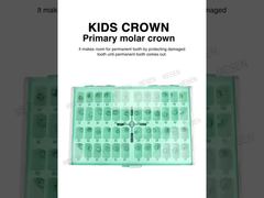 Một cái nhìn cận cảnh hơn: Mão răng hàm sữa KIDS CROWN