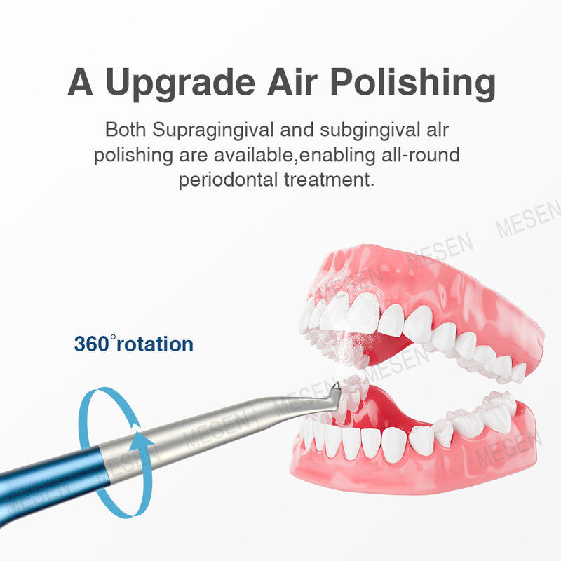 Hệ thống Air Prophy nâng cấp Air Polishing loại bỏ sắc tố, mảng bám, bụi bẩn mềm và Calculus sớm